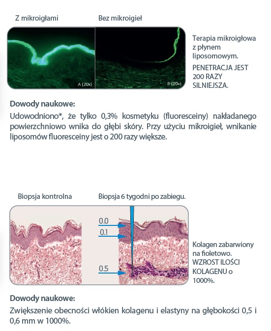 mezoterapia_twarz2